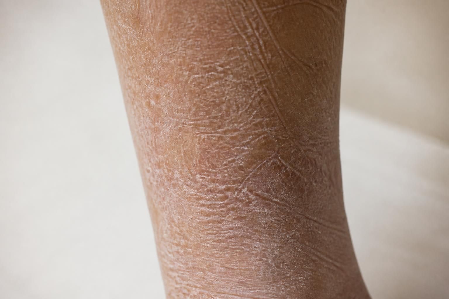découvrez les meilleures crèmes et soins naturels pour hydrater et protéger la peau sèche chez la personne âgée, afin de préserver confort et douceur au quotidien.