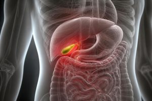 découvrez les risques liés aux maladies de la vésicule biliaire et quand elles peuvent devenir mortelles. informations essentielles pour comprendre et prévenir les complications.