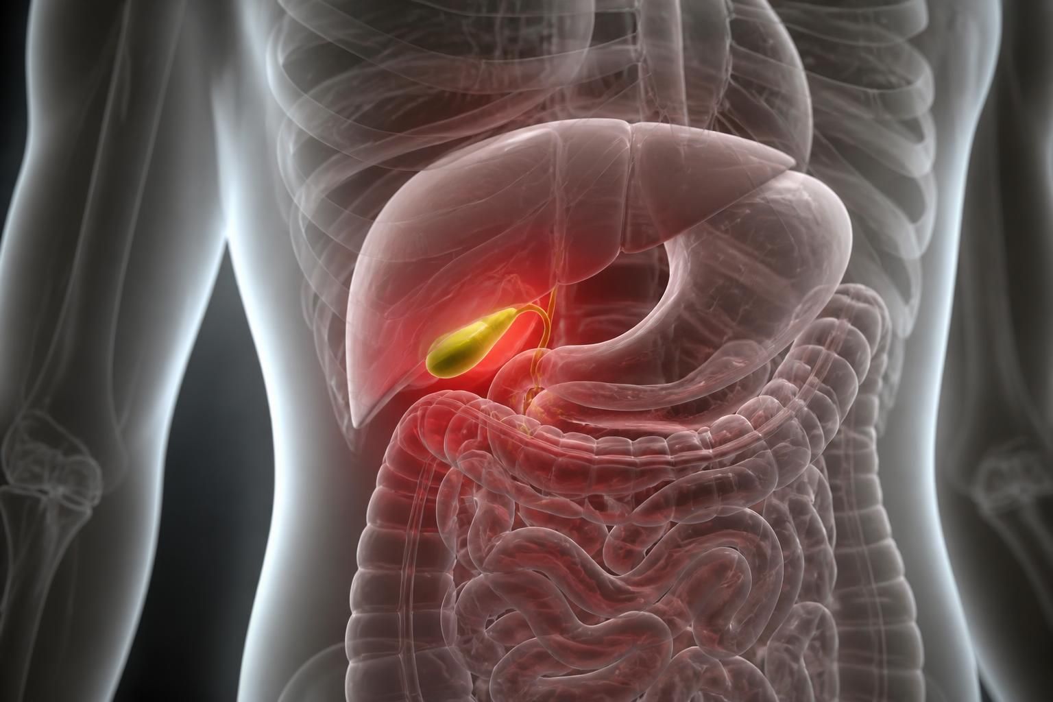 découvrez les risques liés aux maladies de la vésicule biliaire et quand elles peuvent devenir mortelles. informations essentielles pour comprendre et prévenir les complications.
